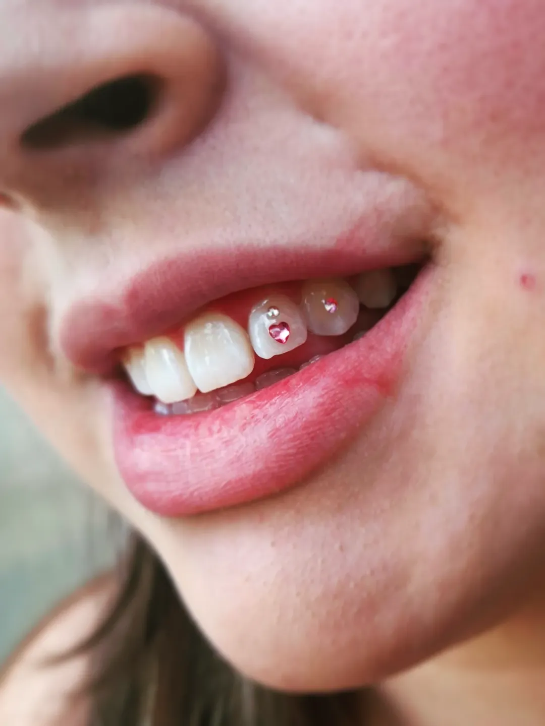 Gemas dentales o Tooth Gems. ¿ De dónde vienen?